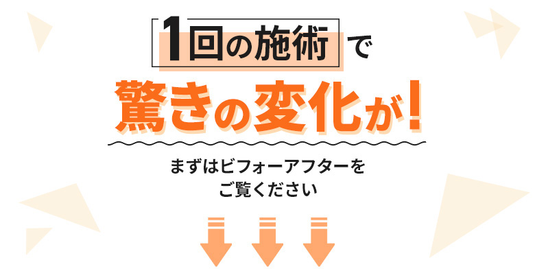 ビフォーアフター